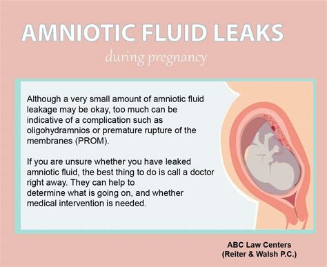 what causes amniotic fluid to leak|Leaking Amniotic Fluid: Signs, Causes, and。